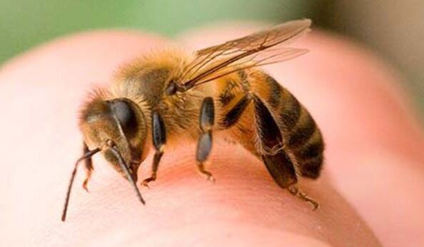 Bee stings - an extreme way of enlarging the phallus